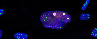 Telomere